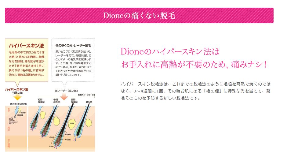 Dione1